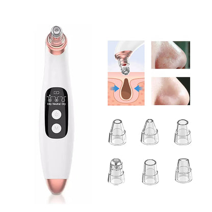 Pore Perfection Blackhead Remover - THIS 'N THAT STORE